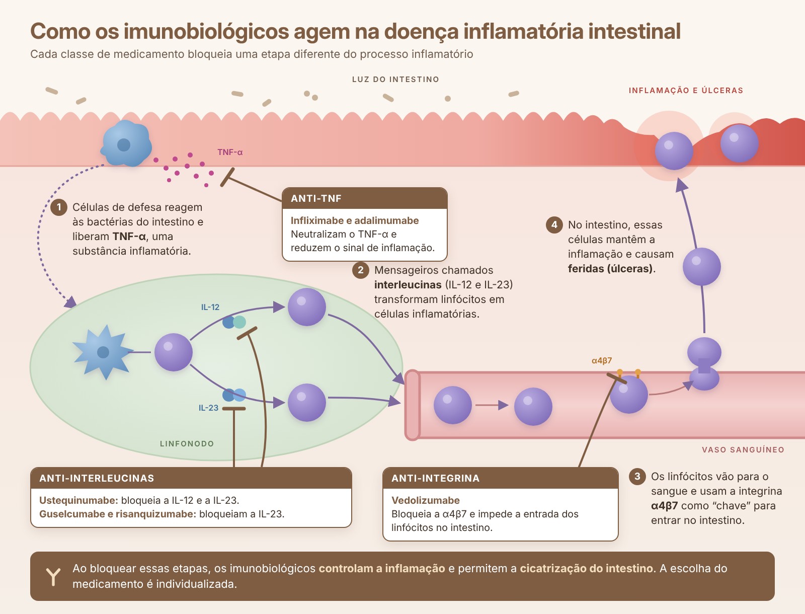 Infográfico: como os imunobiológicos (anti-TNF, anti-interleucinas e anti-integrina) agem na doença inflamatória intestinal